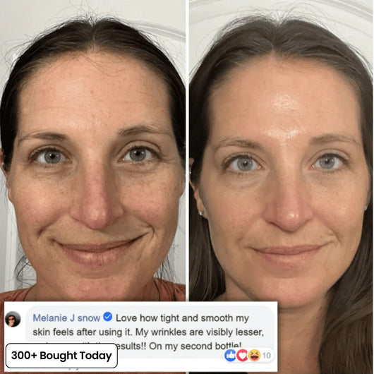 Customer before-and-after photos showing improved skin firmness and smoother-looking complexion with Aldra collagen balm